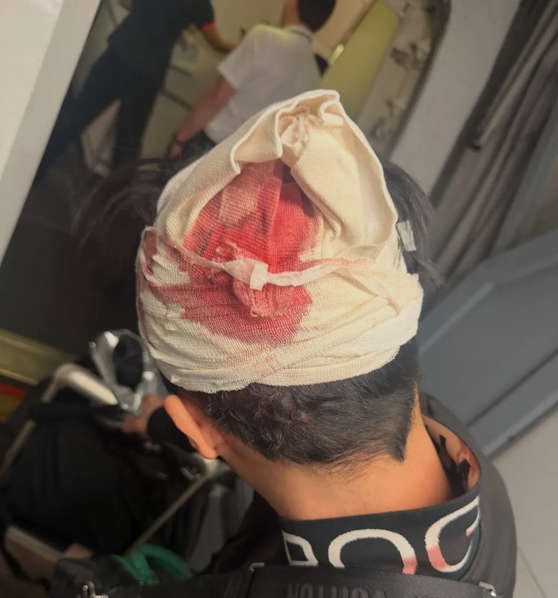 BEAUZ's Johan Yang Hospitalized After In-Flight Head Injury